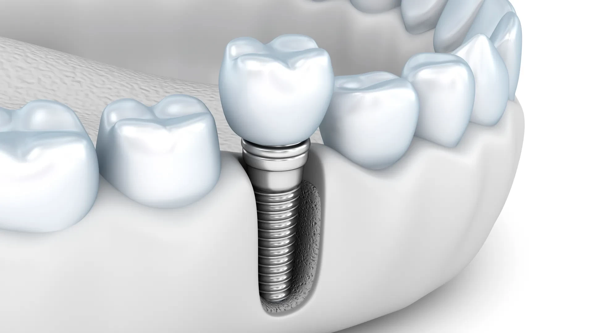 ماهي تخصصات طب الاسنان